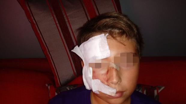 El menor continuúa yendo a la clínica a que le realicen diariamente las curas