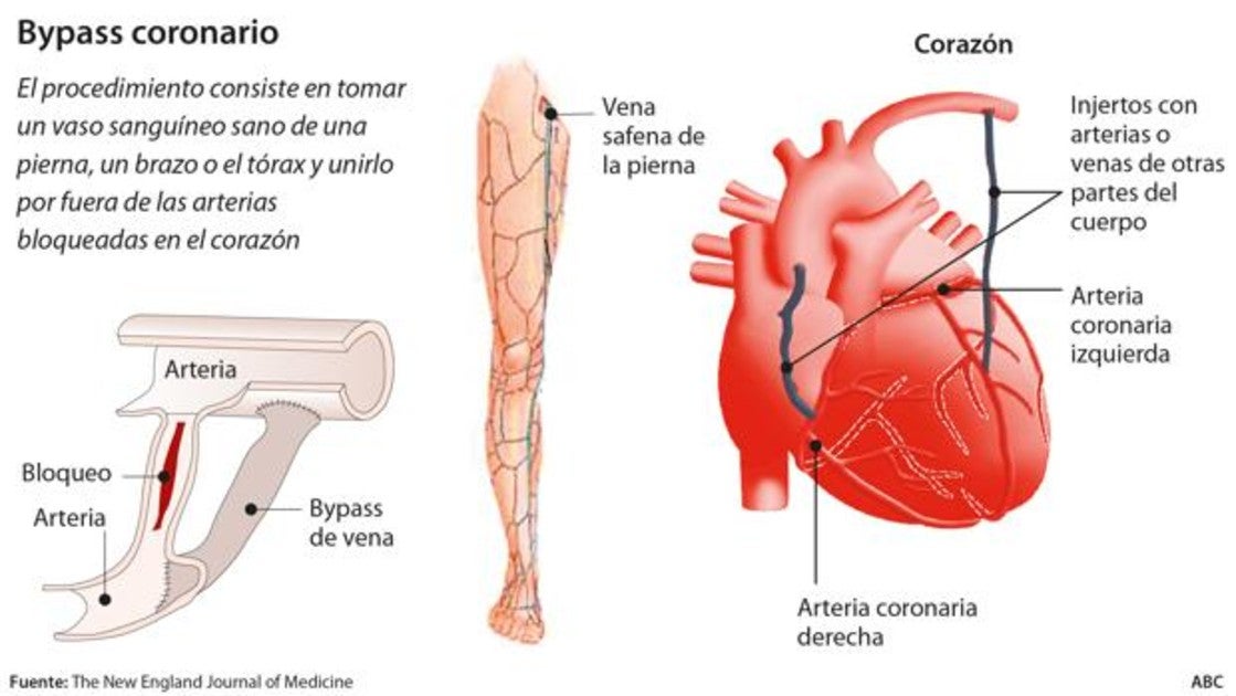 venas y arterias en las piernas